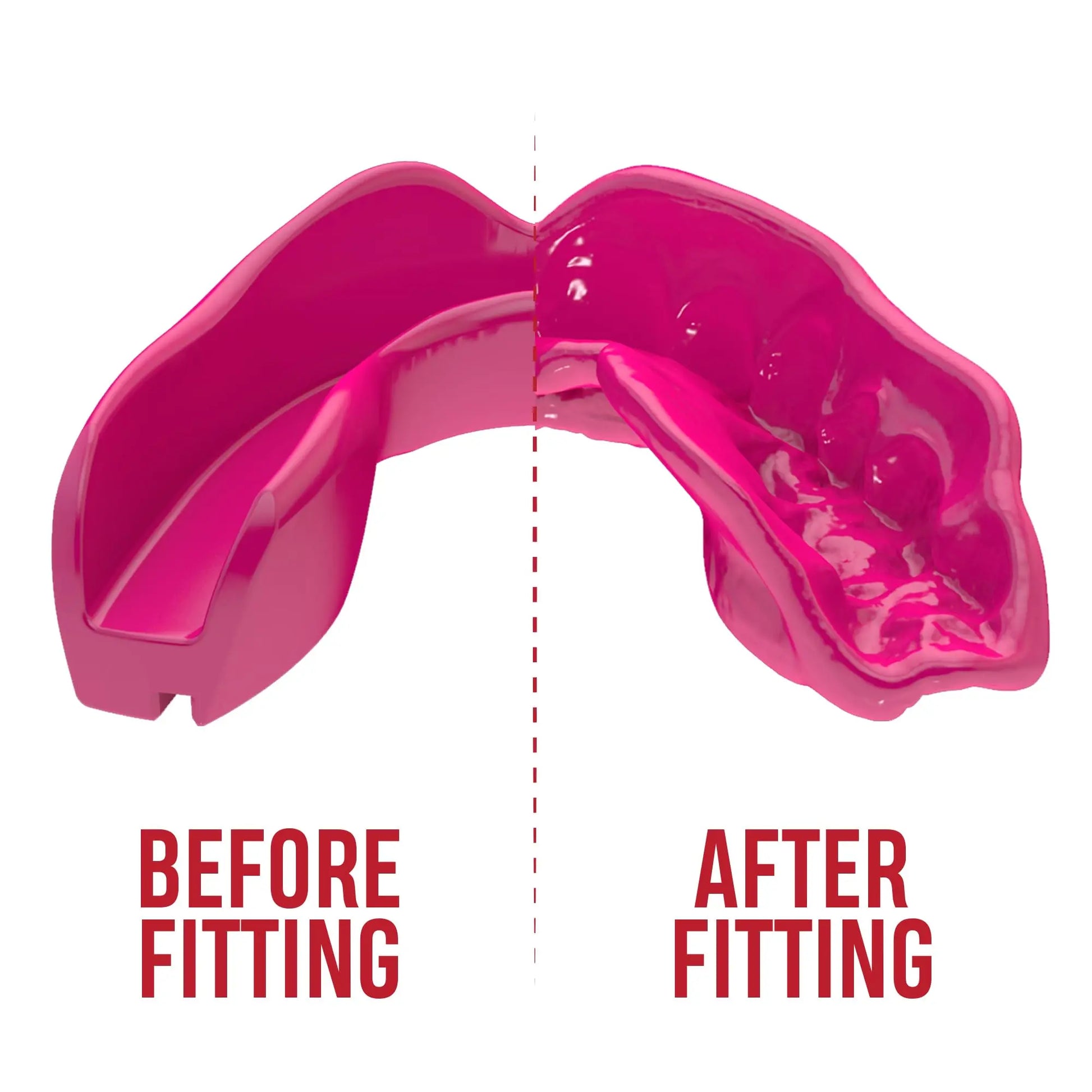 SAFEJAWZ | Mouthguard - The Champ Gear