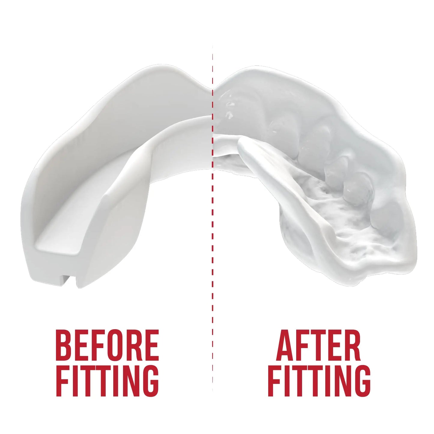 SAFEJAWZ | Mouthguard - The Champ Gear