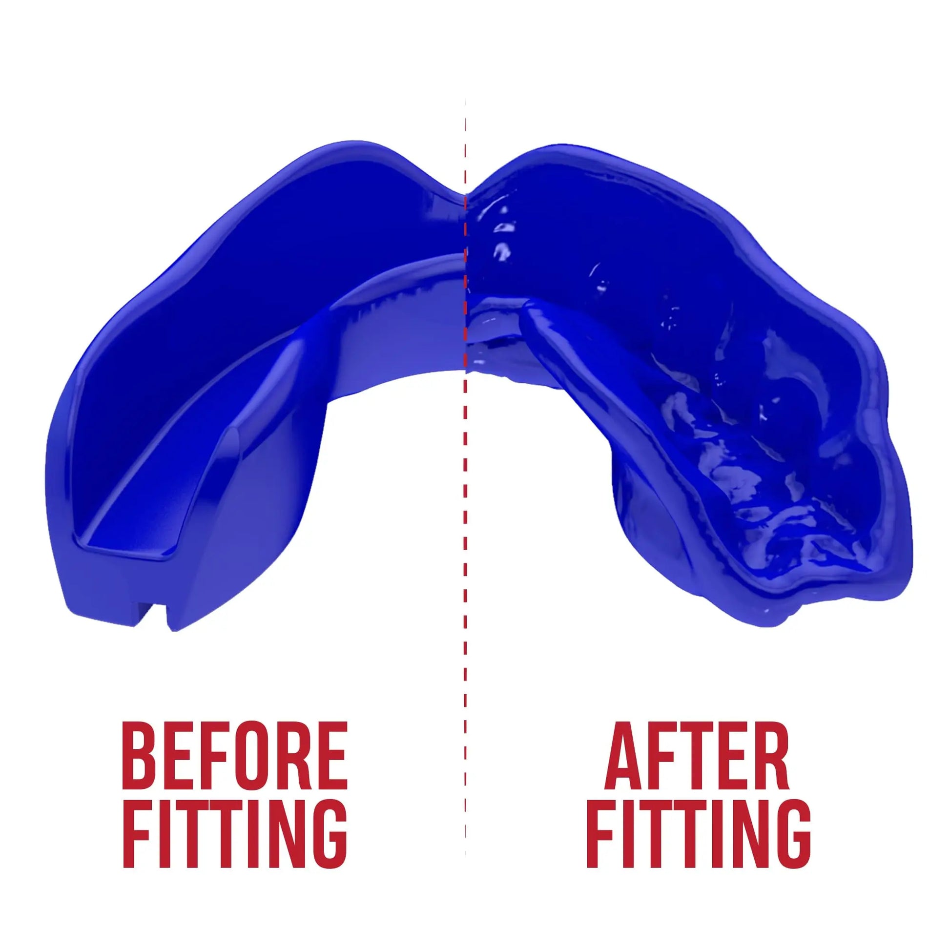 SAFEJAWZ | Mouthguard - The Champ Gear