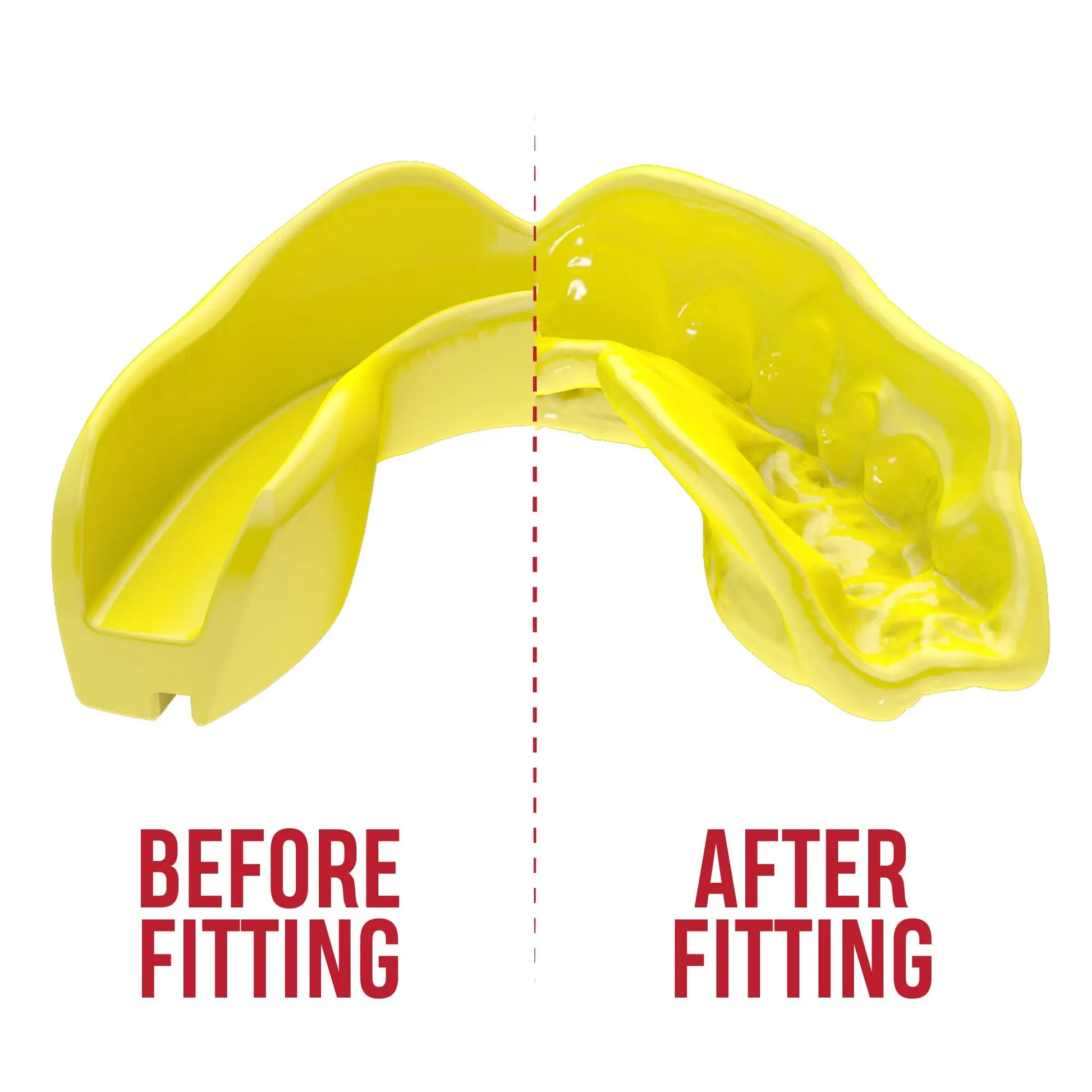 SAFEJAWZ | Mouthguard - The Champ Gear