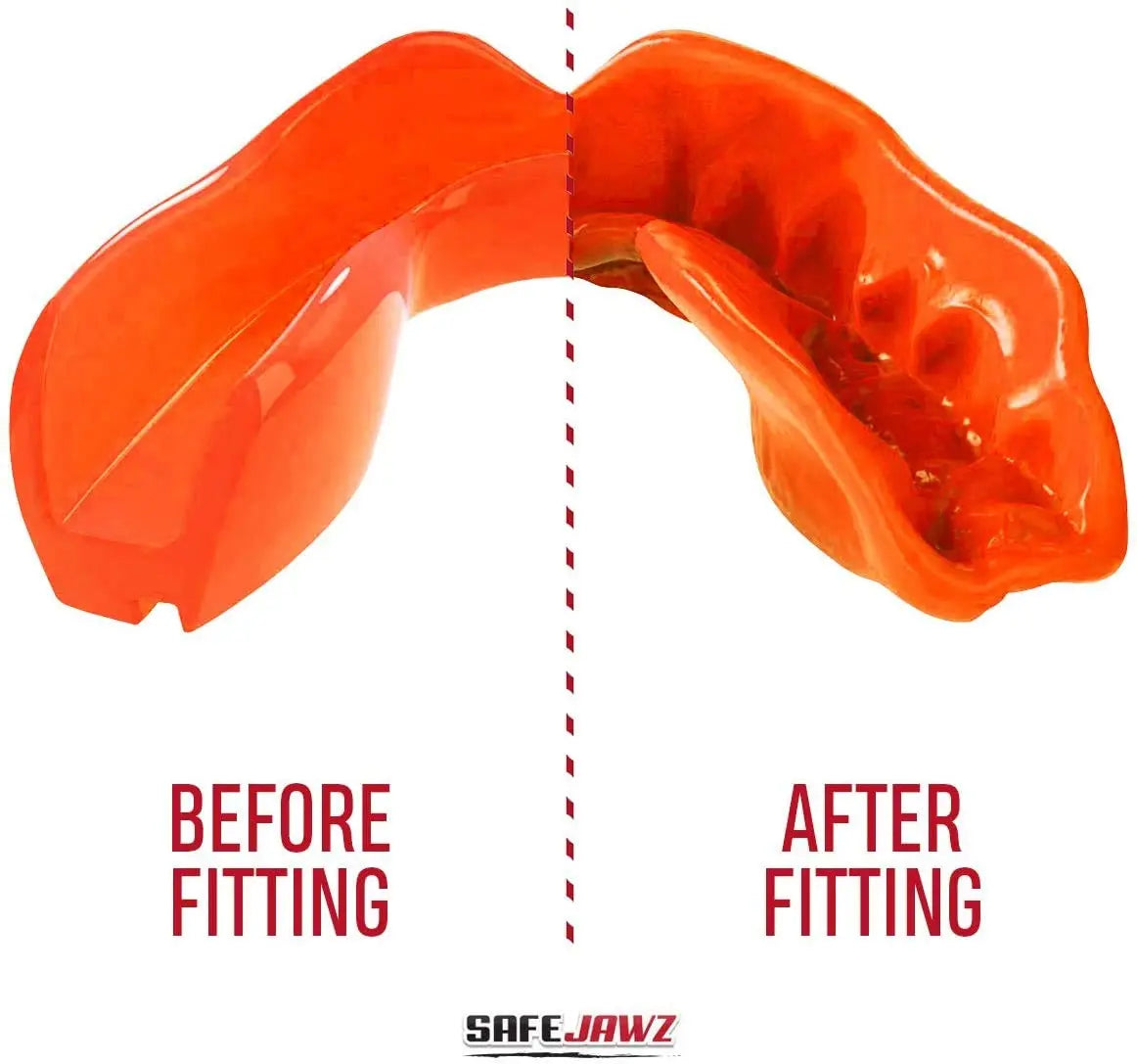 SAFEJAWZ | Mouthguard - The Champ Gear