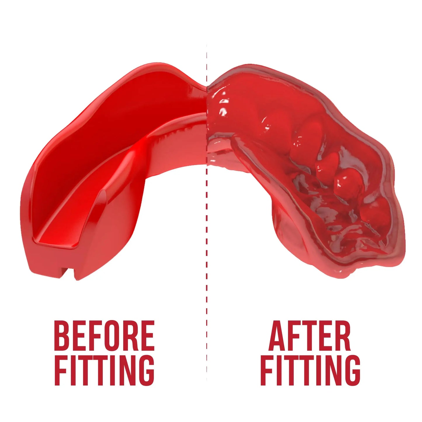 SAFEJAWZ | Mouthguard - The Champ Gear